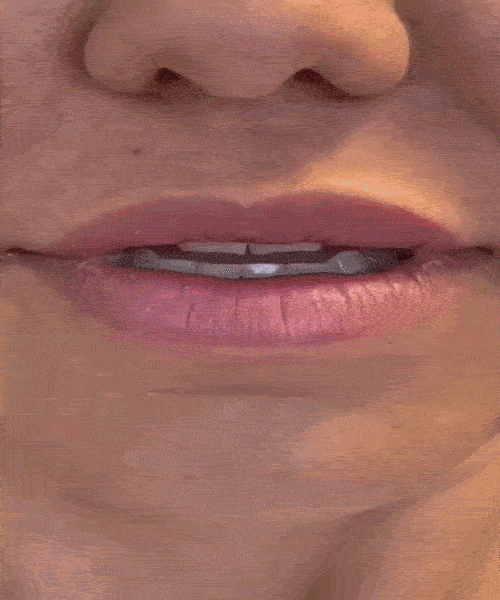 Instant Smile – Accesoriu estetic
