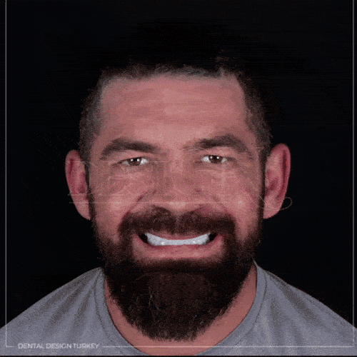 Proteze Dentare Reglabile